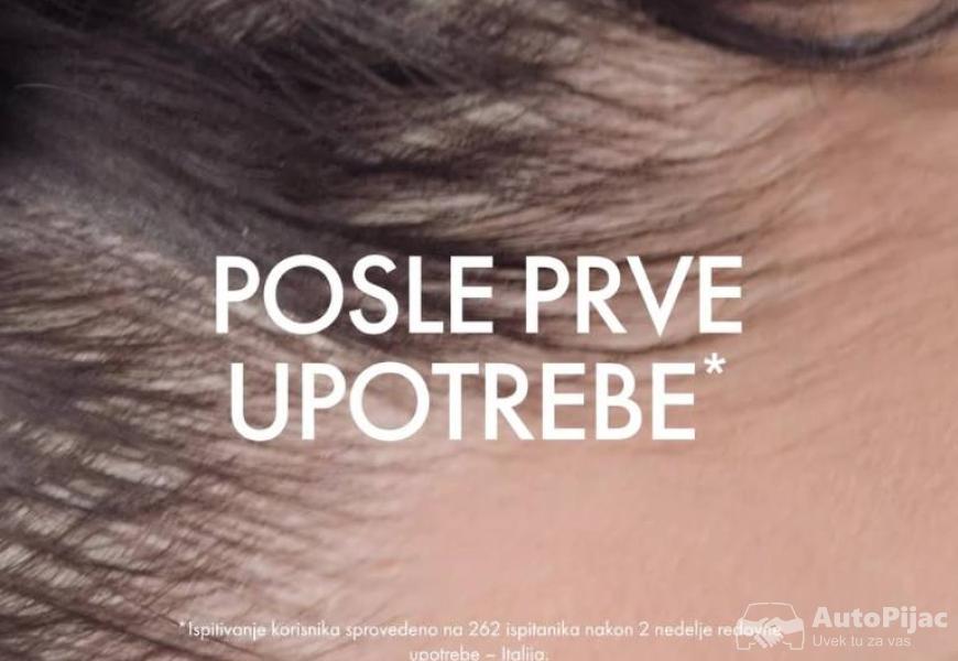 14hdi_7_polovni_automobili_autopijac.rs